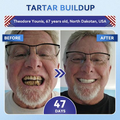 Your Smile~ Borvexis® 🦷 Tideglusib Fast‑Dissolving Tooth & Gum Repair Oral Strips ✨ (𝟓-𝐢𝐧-𝟏 💎 𝐑𝐞𝐛𝐮𝐢𝐥𝐝 𝐄𝐧𝐚𝐦𝐞𝐥 & 𝐃𝐞𝐧𝐭𝐢𝐧 • 𝐒𝐭𝐫𝐞𝐧𝐠𝐭𝐡𝐞𝐧 𝐆𝐮𝐦𝐬 • 𝐄𝐫𝐚𝐝𝐢𝐜𝐚𝐭𝐞 𝐓𝐚𝐫𝐭𝐚𝐫 & 𝐎𝐝𝐨𝐫 • 𝐖𝐡𝐢𝐭𝐞𝐧𝐢𝐧𝐠 • 𝐒𝐭𝐨𝐩 𝐓𝐨𝐨𝐭𝐡 𝐒𝐞𝐧𝐬𝐢𝐭𝐢𝐯𝐢𝐭𝐲)