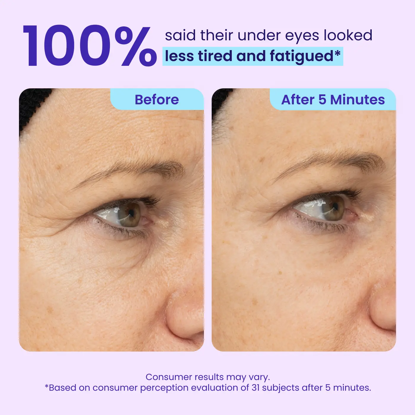 Erase Eye Bags in Minutes — BORVEXIS Eye Cream Look Refreshed Instantly ⚡Flash Sale🔥