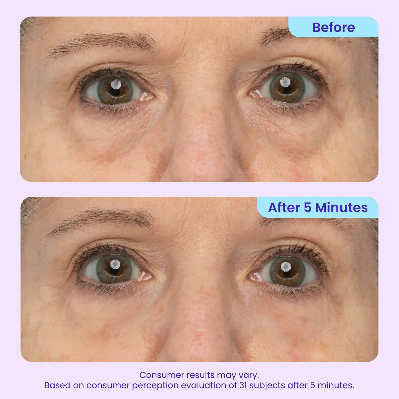 Erase Eye Bags in Minutes — BORVEXIS Eye Cream Look Refreshed Instantly ⚡Flash Sale🔥