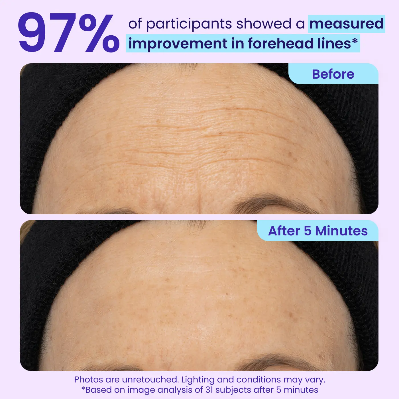 Erase Eye Bags in Minutes — BORVEXIS Eye Cream Look Refreshed Instantly ⚡Flash Sale🔥