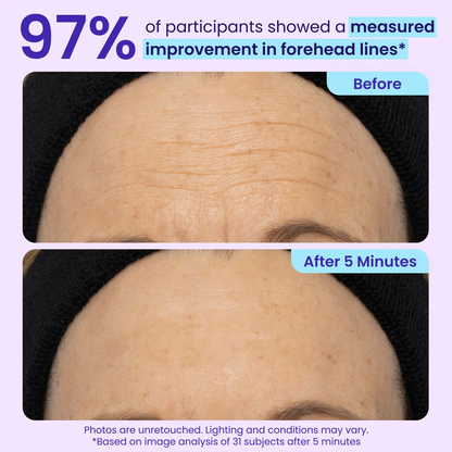 Erase Eye Bags in Minutes — BORVEXIS Eye Cream Look Refreshed Instantly ⚡Flash Sale🔥