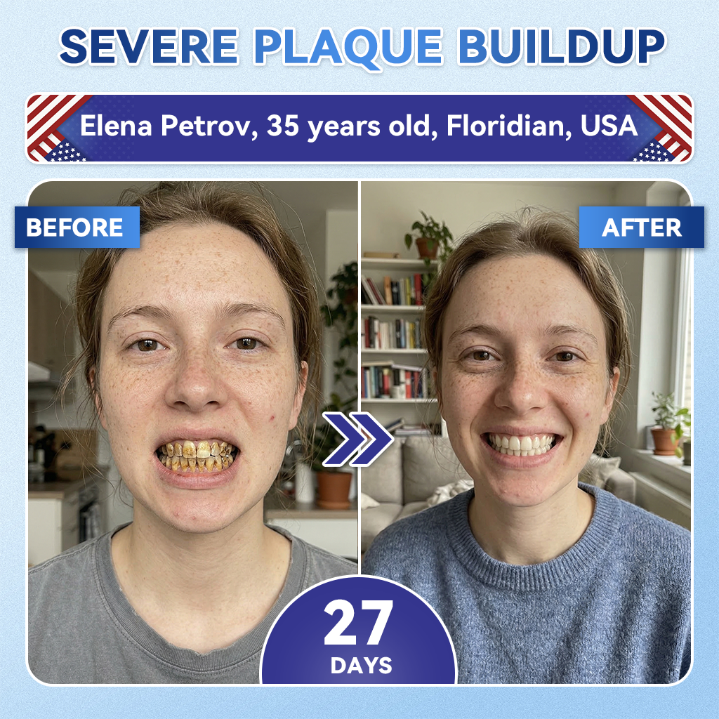 Your Smile~ Borvexis® 🦷 Tideglusib Fast‑Dissolving Tooth & Gum Repair Oral Strips ✨ (𝟓-𝐢𝐧-𝟏 💎 𝐑𝐞𝐛𝐮𝐢𝐥𝐝 𝐄𝐧𝐚𝐦𝐞𝐥 & 𝐃𝐞𝐧𝐭𝐢𝐧 • 𝐒𝐭𝐫𝐞𝐧𝐠𝐭𝐡𝐞𝐧 𝐆𝐮𝐦𝐬 • 𝐄𝐫𝐚𝐝𝐢𝐜𝐚𝐭𝐞 𝐓𝐚𝐫𝐭𝐚𝐫 & 𝐎𝐝𝐨𝐫 • 𝐖𝐡𝐢𝐭𝐞𝐧𝐢𝐧𝐠 • 𝐒𝐭𝐨𝐩 𝐓𝐨𝐨𝐭𝐡 𝐒𝐞𝐧𝐬𝐢𝐭𝐢𝐯𝐢𝐭𝐲)