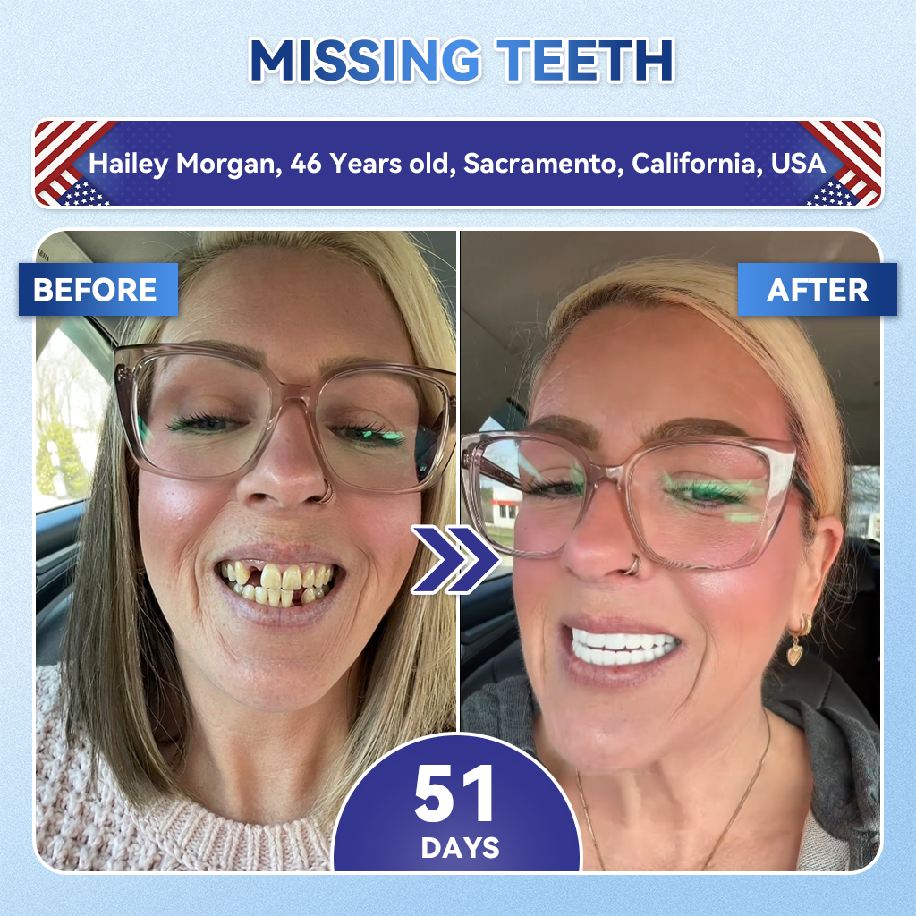 Your Smile~ Borvexis® 🦷 Tideglusib Fast‑Dissolving Tooth & Gum Repair Oral Strips ✨ (𝟓-𝐢𝐧-𝟏 💎 𝐑𝐞𝐛𝐮𝐢𝐥𝐝 𝐄𝐧𝐚𝐦𝐞𝐥 & 𝐃𝐞𝐧𝐭𝐢𝐧 • 𝐒𝐭𝐫𝐞𝐧𝐠𝐭𝐡𝐞𝐧 𝐆𝐮𝐦𝐬 • 𝐄𝐫𝐚𝐝𝐢𝐜𝐚𝐭𝐞 𝐓𝐚𝐫𝐭𝐚𝐫 & 𝐎𝐝𝐨𝐫 • 𝐖𝐡𝐢𝐭𝐞𝐧𝐢𝐧𝐠 • 𝐒𝐭𝐨𝐩 𝐓𝐨𝐨𝐭𝐡 𝐒𝐞𝐧𝐬𝐢𝐭𝐢𝐯𝐢𝐭𝐲)